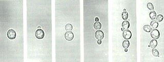 酵母菌假菌丝的形成.jpg